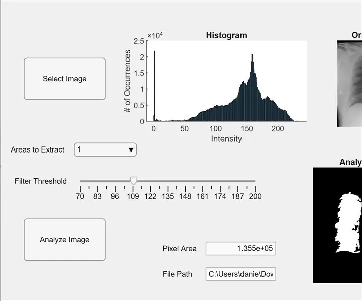 تجزئة الرئة MatLab: 5 خطوات