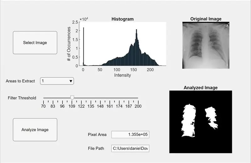 MatLab kopsude segmenteerimine