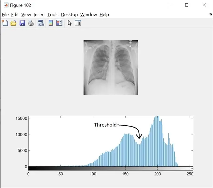 Korak 2: Filtriranje šuma i histogram