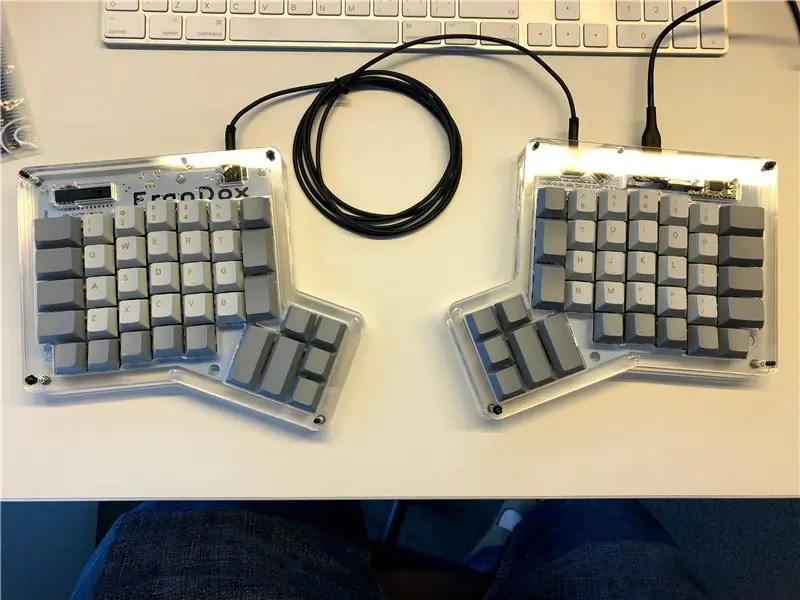 ErgoDox մեխանիկական ստեղնաշար