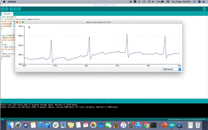 Elektrokardiogram (EKG) készítése