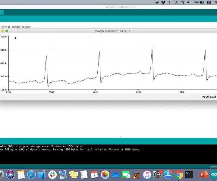 Hvordan bygge et elektrokardiogram (EKG): 5 trinn