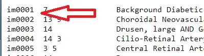 Seleccioneu 10 imatges normals dels ulls i 10 imatges amb símptomes de retinopatia diabètica