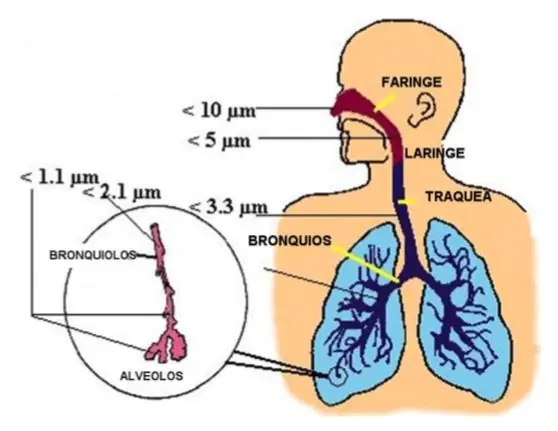 เหตุใดจึงสำคัญที่ต้องดูแลเรื่องฝุ่นละอองเหล่านั้น