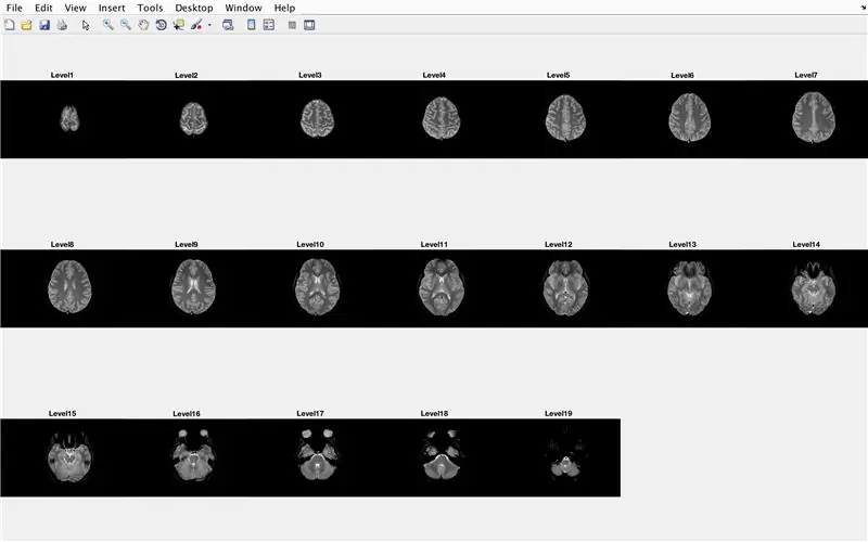 Menggunakan Brain Box