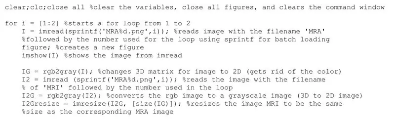 Cargue imágenes en MATLAB y asigne imágenes a una variable para mostrar imágenes