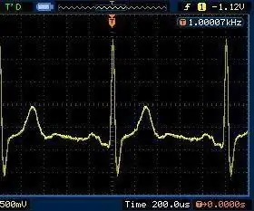 Tehke oma elektrokardiogramm (EKG): 6 sammu