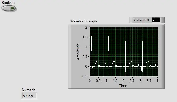 LabVIEW لرسم شكل موجة ECG وحساب معدل ضربات القلب (نبضة في الدقيقة)