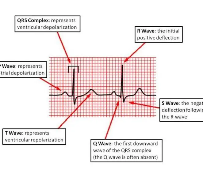 EKG shēma (PSpice, LabVIEW, maizes dēlis): 3 soļi