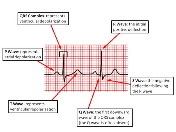 EKG krug (PSpice, LabVIEW, Breadboard)