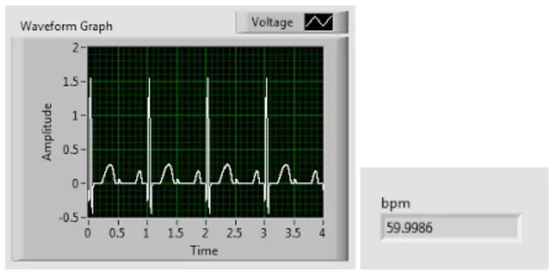 Lihtne EKG vooluring ja LabVIEW südame löögisageduse programm