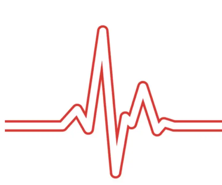 EKG a monitor srdcového tepu: 6 krokov