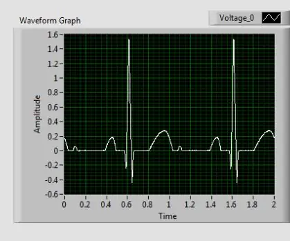 دائرة تسجيل تخطيط القلب البسيطة ومراقب معدل ضربات القلب LabVIEW: 5 خطوات