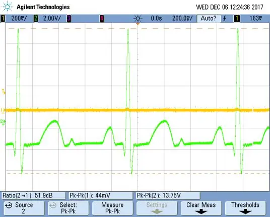 Digitaler EKG- und Herzfrequenzmonitor