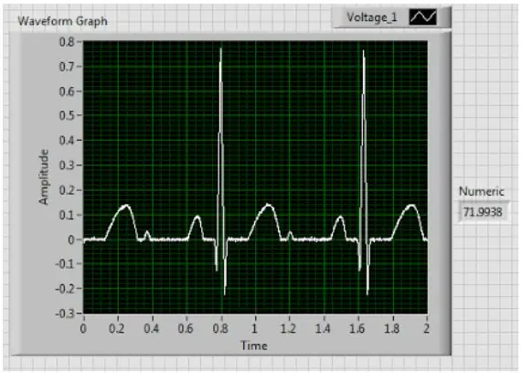 Kerää EKG -tietoja