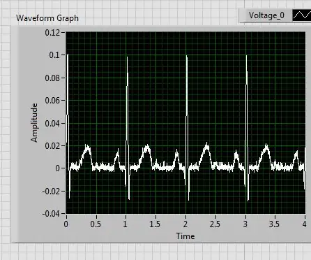 Cum să construiți un monitor digital ECG și ritm cardiac: 6 pași