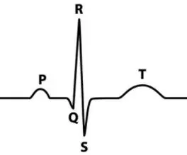 Teev Npe Bioelectric Cov Cim: ECG thiab Lub Plawv Saib Xyuas Lub Plawv: 7 Kauj Ruam