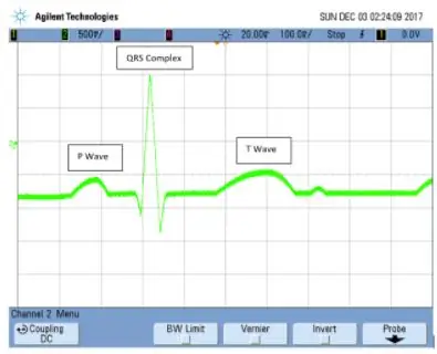 Barcha 3 komponentni birlashtiring va elektrokardiogrammani simulyatsiya qiling (EKG)