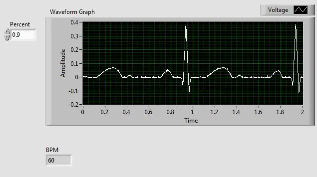 Codifique o LabView para analisar os componentes do sinal de ECG e calcular a pulsação