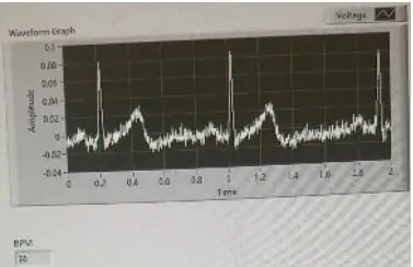 Kombinera kretsen och LabView -komponenterna och anslut till en riktig person