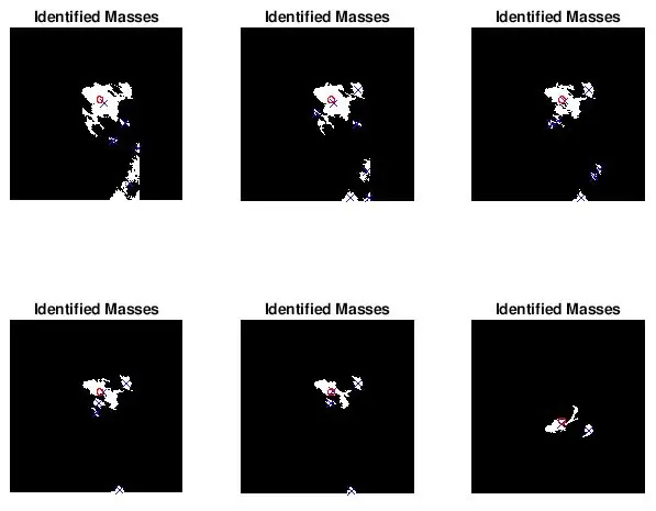 Representació de la ubicació i la mida de la massa diagnosticada per a la comparació visual