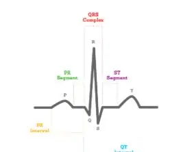 Circuit de electrocardiogramă: 4 pași